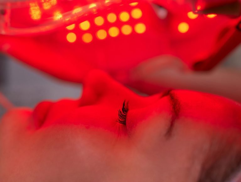 Mujer recibe tratamiento de luz roja para el cuidado del acné.